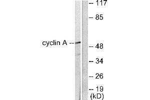 Western blot analysis of extracts from COS7 cells, using Cyclin A antibody (#C0165). (Cyclin A antibody)