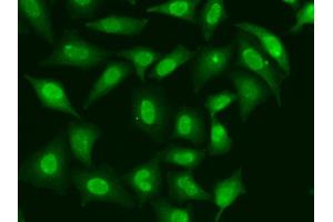 Immunofluorescence analysis of HeLa cells using TREX1 antibody (ABIN5974106). (TREX1 antibody)