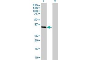 Western Blot analysis of ITGAV expression in transfected 293T cell line by ITGAV MaxPab polyclonal antibody. (CD51 antibody  (AA 1-1048))