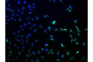 Immunofluorescence staining of A549 cells with ABIN7144159 at 1:100, counter-stained with DAPI. (ANKRD5 antibody  (AA 411-698))