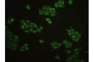 Detection of TERF2 in Human Hela Cells using Polyclonal Antibody to Telomeric Repeat Binding Factor 2 (TERF2) (TRF2 antibody  (AA 144-438))