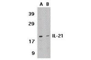 Western Blotting (WB) image for anti-Interleukin 21 (IL21) (Center) antibody (ABIN2474977) (IL-21 antibody  (Center))