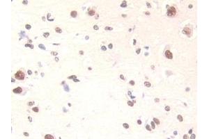 Immunohistochemistry (IHC) image for anti-Family with Sequence Similarity 19 (Chemokine (C-C Motif)-Like), Member A3 (FAM19A3) (AA 44-130) antibody (ABIN7441964)