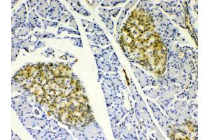 IHC analysis of HSPB8/Hsp22 using anti- HSPB8/Hsp22 antibody . (HSPB8 antibody  (AA 1-196))