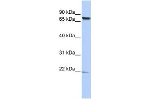 Western Blotting (WB) image for anti-Chromosome 7 Open Reading Frame 38 (C7orf38) antibody (ABIN2459912) (FAM200A antibody)