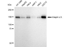 Western blotting analysis using Integrin alpha 5 antibody (ABIN7799076).