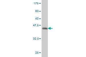 Western Blot detection against Immunogen (36. (QPRT antibody  (AA 198-297))