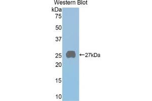 Detection of Recombinant PRLR, Rat using Polyclonal Antibody to Prolactin Receptor (PRLR) (Prolactin Receptor antibody  (AA 20-229))