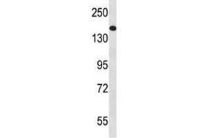 NPC1 antibody  (AA 591-620)