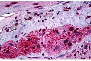 Human Intestine, Ganglion Cells: Formalin-Fixed, Paraffin-Embedded (FFPE) (STAT1 antibody  (pSer727))