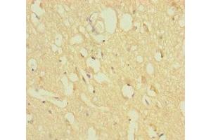 Immunohistochemistry of paraffin-embedded human brain tissue using ABIN7176279 at dilution of 1:100 (ZNF396 antibody  (AA 1-200))