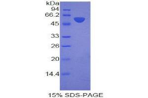 SDS-PAGE (SDS) image for Laminin, beta 3 (LAMB3) (AA 352-587) protein (His tag,GST tag) (ABIN2123146) (Laminin beta 3 Protein (AA 352-587) (His tag,GST tag))