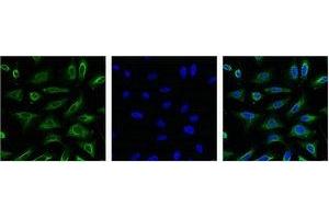 IF analysis of Hela with antibody (Left) and DAPI (Right) diluted at 1:100. (Aquaporin 4 antibody)