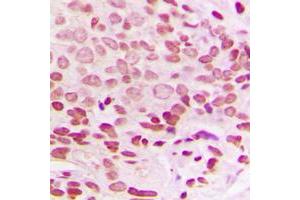 Immunohistochemical analysis of Histone H1. (Histone H1 antibody  (Center))