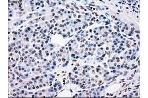 Image no. 2 for anti-B-Raf proto-oncogene, serine/threonine kinase (BRAF) antibody (ABIN1496954) (BRAF antibody)