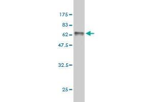 Western Blot detection against Immunogen (63. (RRAGB antibody  (AA 1-346))