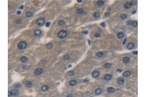 Detection of ALDH1A1 in Human Liver Tissue using Polyclonal Antibody to Aldehyde Dehydrogenase 1 Family, Member A1 (ALDH1A1) (ALDH1A1 antibody  (AA 2-501))