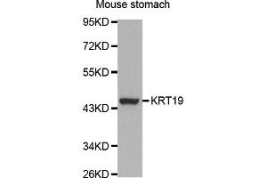 Western blot analysis of extracts of mouse stomach, using KRT19 antibody (ABIN5970077) at 1/1000 dilution.