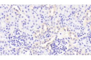 Detection of GM-CSF in Mouse Kidney Tissue using Polyclonal Antibody to Colony Stimulating Factor 2, Granulocyte Macrophage (GM-CSF) (GM-CSF antibody  (AA 19-141))