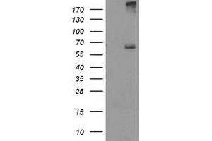 Western Blotting (WB) image for anti-Ribophorin 1 (RPN1) antibody (ABIN1500755) (RPN1 antibody)