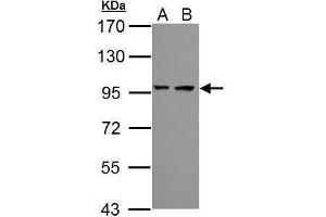 WB Image Sample (30 ug of whole cell lysate) A: JC B: BCL-1 7. (PSMD2 antibody)