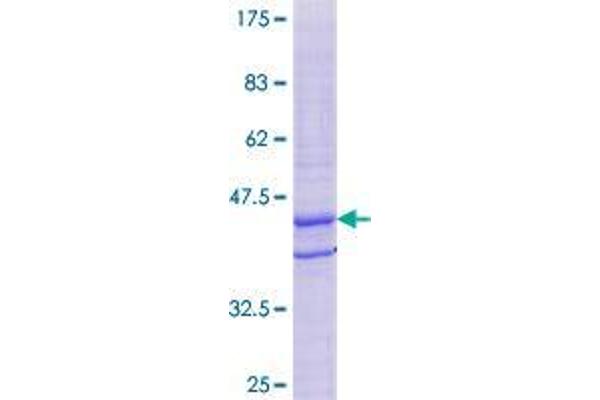 TPD52L3 Protein (AA 1-140) (GST tag)