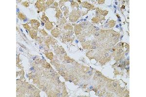 Immunohistochemistry of paraffin-embedded Human stomach using BEST1 Polyclonal Antibody at dilution of 1:100 (40x lens). (Bestrophin 1 antibody)