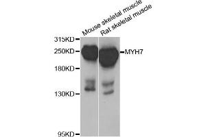 Western blot analysis of extracts of mouse skeletal muscle and rat skeletal muscle cell lines, using MYH7 antibody.