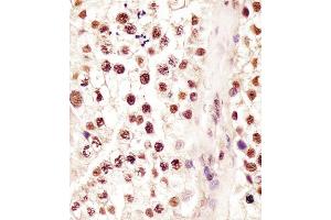(ABIN6244063 and ABIN6578228) staining RBMX in human testis tissue sections by Immunohistochemistry (IHC-P - paraformaldehyde-fixed, paraffin-embedded sections). (RBMX antibody  (AA 262-294))