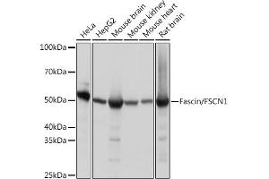 Western blot analysis of extracts of various cell lines, using Fascin/FSCN1 Rabbit mAb (ABIN7267142) at 1:1000 dilution. (Fascin antibody)
