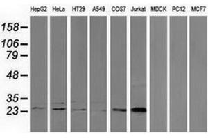 Western blot analysis of extracts (35 µg) from 9 different cell lines by using anti-CLPP monoclonal antibody. (CLPP antibody)