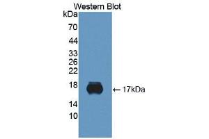 Western blot analysis of the recombinant protein. (SIGLEC10 antibody)
