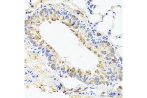 Immunohistochemistry of paraffin-embedded mouse lung using BGLAP antibody (ABIN5975009) at dilution of 1/100 (40x lens). (Osteocalcin antibody)