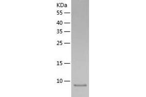 Western Blotting (WB) image for Resistin Like beta (RETNLB) (AA 24-105) protein (His tag) (ABIN7124830) (RETNLB Protein (AA 24-105) (His tag))