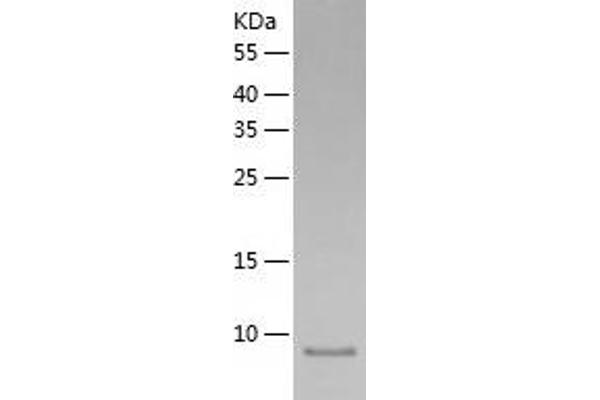 RETNLB Protein (AA 24-105) (His tag)