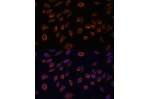 Immunofluorescence analysis of L929 cells using NTPCR antibody (ABIN7269059) at dilution of 1:100. (C1orf57 antibody  (AA 91-190))