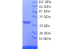 SDS-PAGE (SDS) image for Junctional Adhesion Molecule 2 (JAM2) (AA 29-238), (Extracellular) protein (His tag) (ABIN5713572)