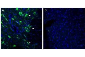 Expression of SLC6A15 in rat dorsal Raphe nucleus.