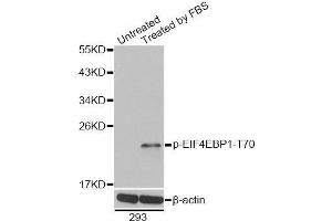 Western blot analysis of extracts of 293 cells, using Phospho-EIF4EBP1-T70 antibody. (eIF4EBP1 antibody  (pThr70))