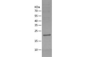 Western Blotting (WB) image for Thiamine Triphosphatase (THTPA) (AA 1-230) protein (His tag) (ABIN7125353) (THTPA Protein (AA 1-230) (His tag))