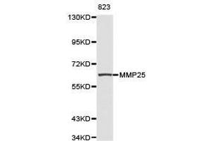 Western Blotting (WB) image for anti-Matrix Metallopeptidase 25 (MMP25) antibody (ABIN1873725) (MMP25 antibody)