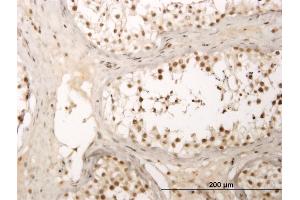 Immunoperoxidase of monoclonal antibody to ZNF213 on formalin-fixed paraffin-embedded human testis. (ZNF213 antibody  (AA 133-242))