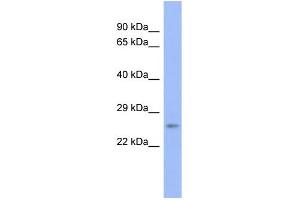 WB Suggested Anti-PSMB6  Antibody Titration: 0. (PSMB6 antibody  (N-Term))