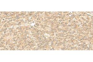Immunohistochemistry of paraffin-embedded Human tonsil tissue using ENSA Polyclonal Antibody at dilution of 1:40(x200)