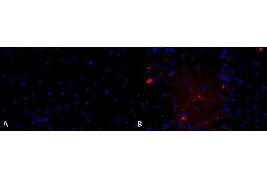 SNCA Protein (Ala53Thr-Mutant)