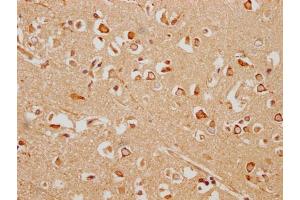 IHC image of ABIN7154933 diluted at 1:200 and staining in paraffin-embedded human brain tissue performed on a Leica BondTM system. (HHIP antibody  (AA 183-424))