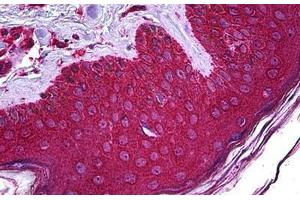 Human Skin: Formalin-Fixed, Paraffin-Embedded (FFPE) (ABHD5 antibody  (AA 1-350))