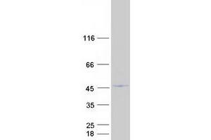 Western Blotting (WB) image for G Patch Domain and Ankyrin Repeats 1 (GPANK1) protein (Myc-DYKDDDDK Tag) (ABIN2714712)
