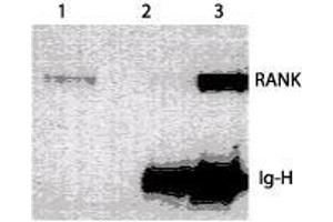 Image no. 1 for anti-Tumor Necrosis Factor Receptor Superfamily, Member 11a, NFKB Activator (TNFRSF11A) (Extracellular Domain) antibody (ABIN208201) (TNFRSF11A antibody  (Extracellular Domain))