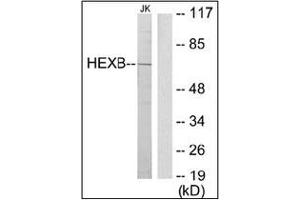 Western blot analysis of extracts from Jurkat cells using HEXB Antibody . (HEXB antibody  (C-Term))